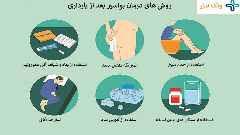 چگونه هموروئید بعد از زایمان طبیعی را درمان کنیم؟