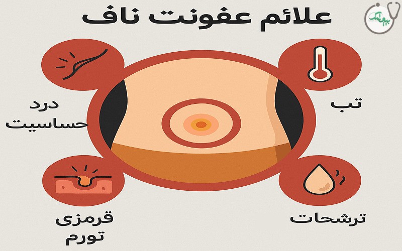 عفونت ناف چیست و چگونه درمان می شود؟