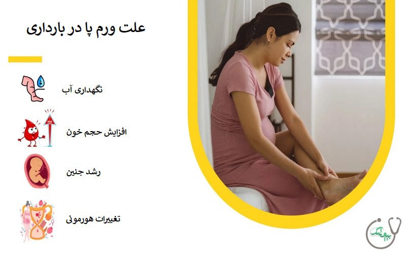 علت ورم پا در بارداری چیست و چه زمانی خطرناک است؟