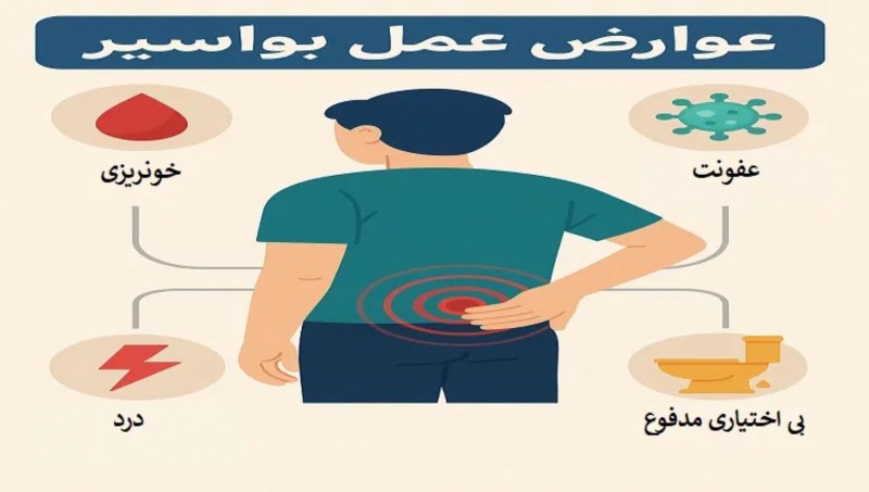 عوارض جانبی عمل بواسیر چیست؟
