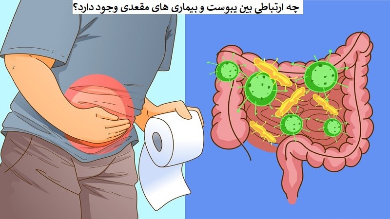 کدام بیماری های مقعدی از یبوست ناشی می شوند؟