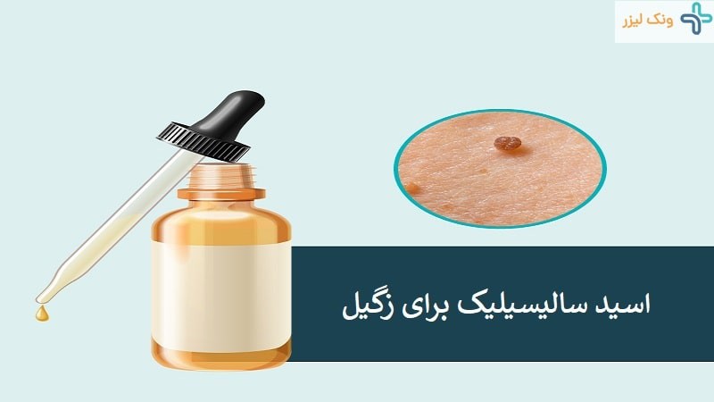 قبل از استفاده از اسید سالیسیلیک روی زگیل تناسلی بخوانید