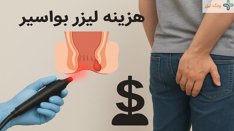 هزینه عمل جراحی بواسیر با لیزر