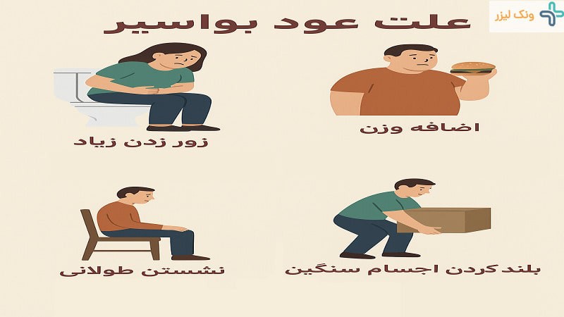 نشانه های عود بواسیر و پیشگیری از آن
