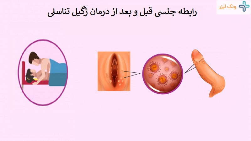 آیا با داشتن زگیل تناسلی میتوان رابطه داشت؟