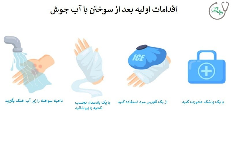 8 روش برای درمان سوختگی با آب جوش