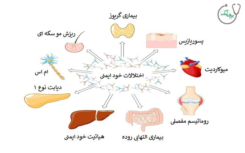 بیماری خود ایمنی چگونه درمان می شود؟