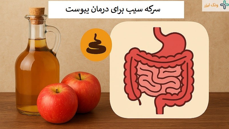 سرکه سیب چه خواصی برای یبوست دارد؟