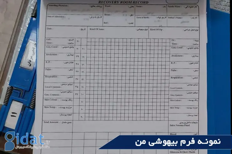 ماجرای عمل بینی من