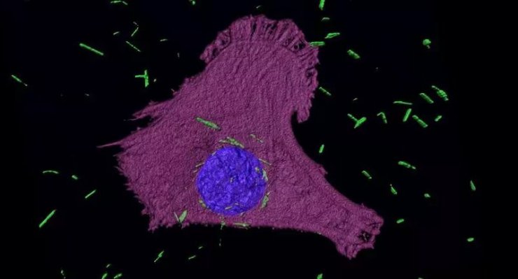 نابودی سلول های سرطانی به کمک نانوذرات شبیه به گلوله و لیزر
