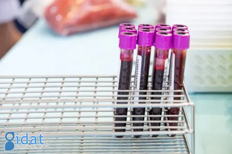 آزمایش خون آلزایمر