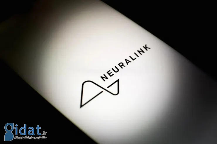 با Neuralink، ایلان ماسک تله پاتی و کنترل اشیاء را با افکار امکان پذیر می کند
