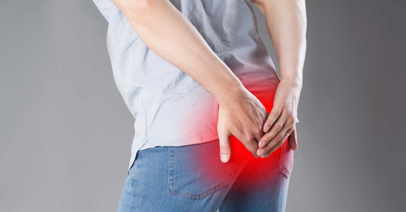 بیماری هموروئید چیست؟ بهترین درمان برای بواسیر