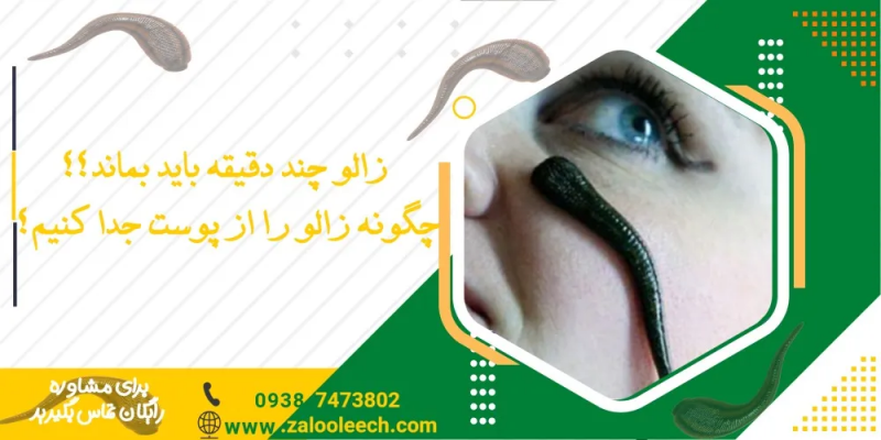 زالو چند دقیقه باید روی پوست بماند؟ راهنمای تخصصی : idat.ir