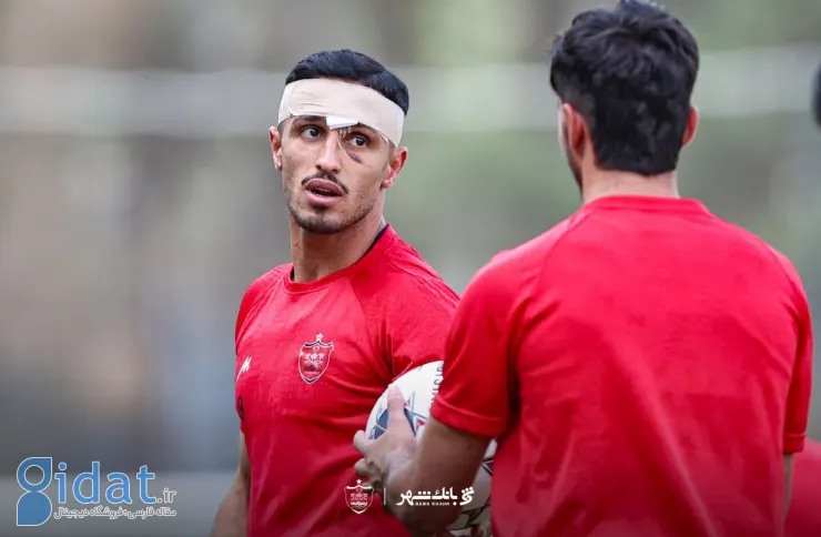 علیپور: ترسیدم بینایی‌ام را از دست بدهم