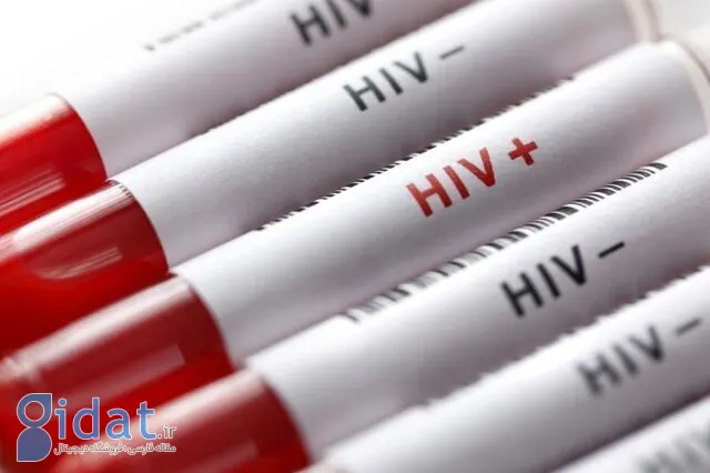 واقعیت انتقال HPV از استخرهای شنا و توالت‌های عمومی