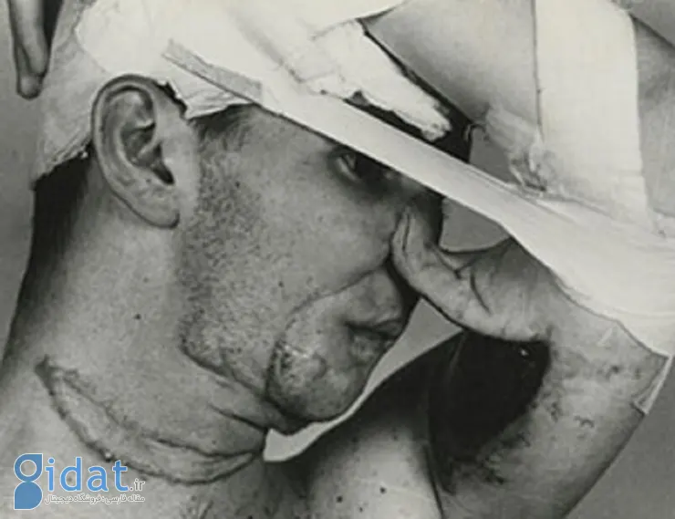 اولین جراحی زیبایی در تاریخ چه زمانی انجام شد؟
