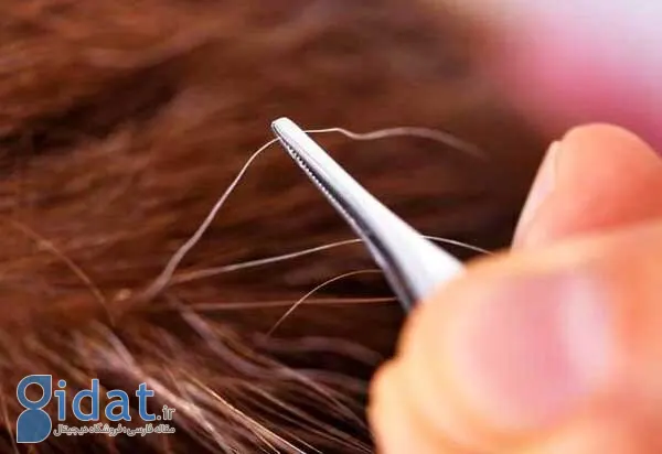 آیا می‌توان از سفید شدن مو جلوگیری کرد؟