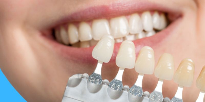 عمده فروش انواع وسایل دندانپزشکی