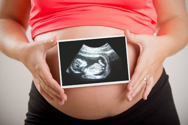 انواع سونوگرافی در مراحل مختلف بارداری