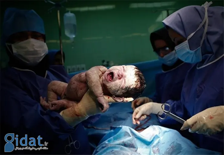 اتفاق ناگواری که سالانه برای ۷۵ هزار زن ایرانی رخ می دهد