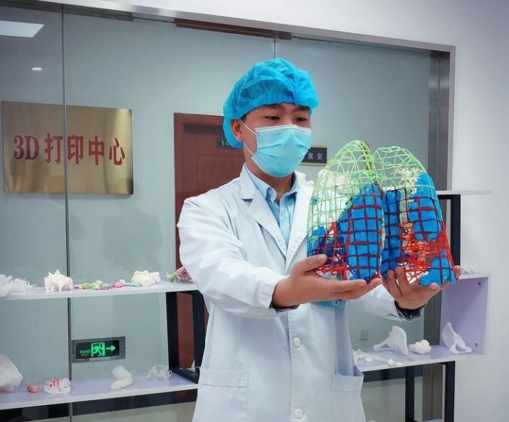 (تصویر) ماکت ریه آلوده به کرونا در چین ساخته شد