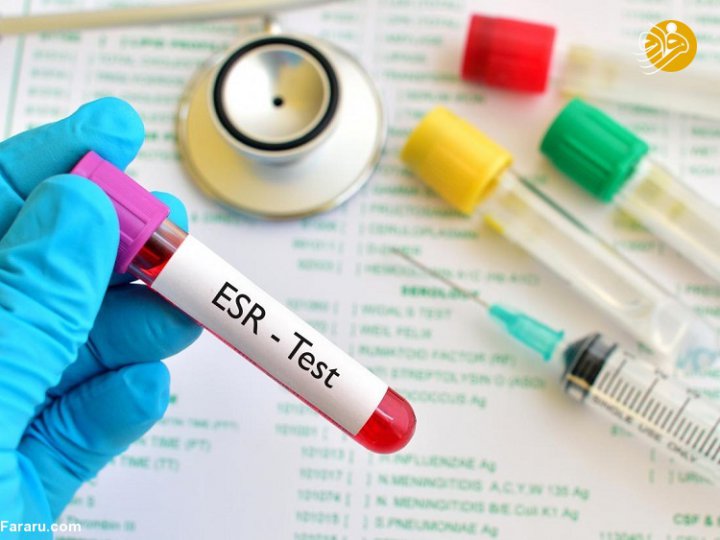 تست ESR خون چیست؟