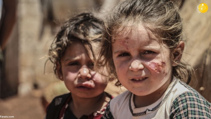 (تصاویر) سالک؛ بلای جان کودکان آواره سوری