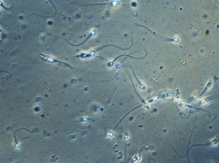 کشف یک خطای علمی پس از ۳۴۰ سال؛ اسپرم شنا نمی کند، می چرخد