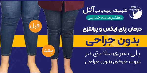 پاچنبری چیست؟ روش های درمانی