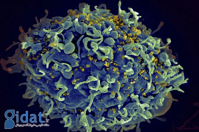 هفتمین فرد در جهان از شر HIV خلاص شد