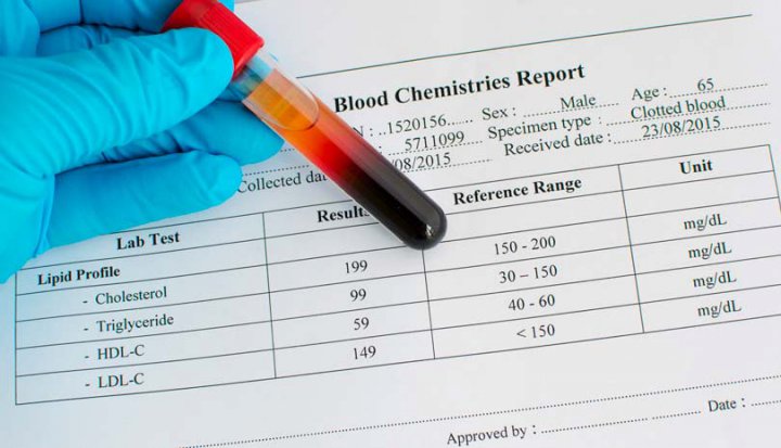 کلسترول خون چقدر باید باشد؟ کلسترول خون نرمال در سنین مختلف