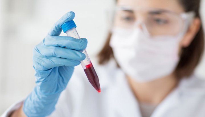 انواع آزمایش خون برای تشخیص و پیشگیری از بیماری ها