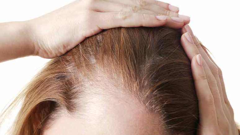 تونیک ضد ریزش مو چیست و چه کاربردی دارد؟ + نحوه مصرف